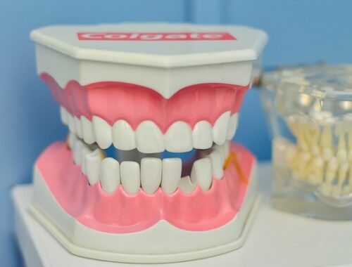 model szczęki z zębami